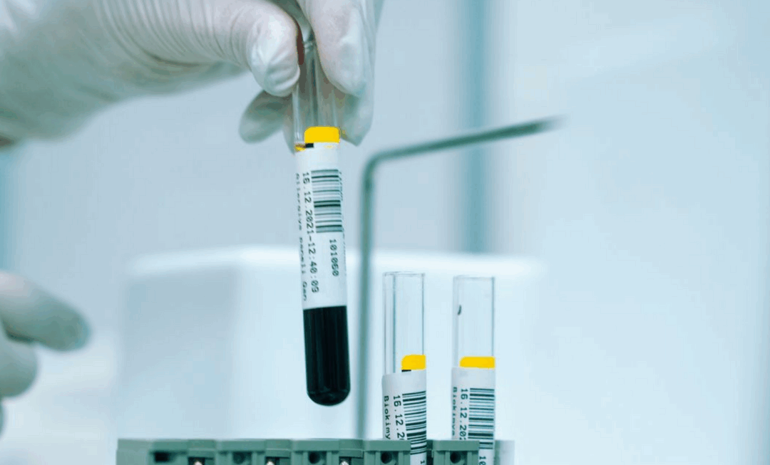 McMaster and Local Hospitals Personalize Cancer Treatment