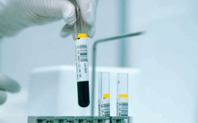 McMaster and Local Hospitals Personalize Cancer Treatment