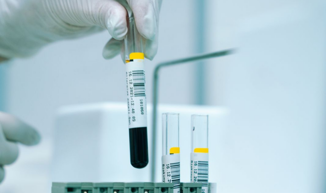 Hand holding blood samples in a lab.